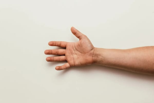 Rhizarthrose traitement : options et solutions pour soulager votre douleur