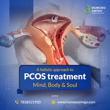 pcos treatment