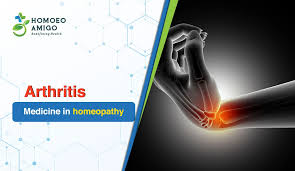 Arthritis Medicine in Homeopathy