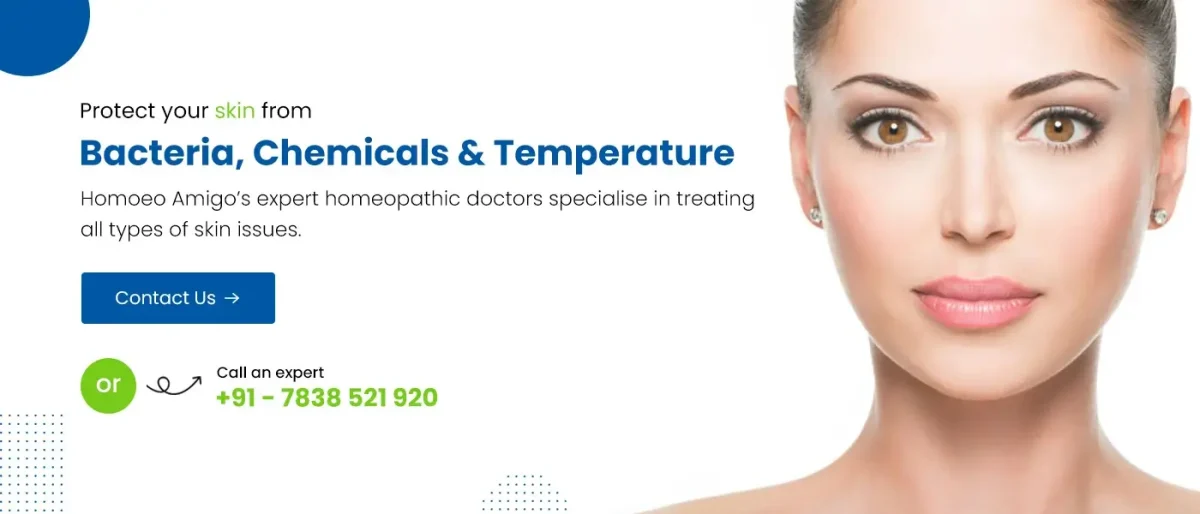 Skin Homeopathic Treatment