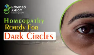 Healing Naturally With Homeopathic Medicines for Dark Circles