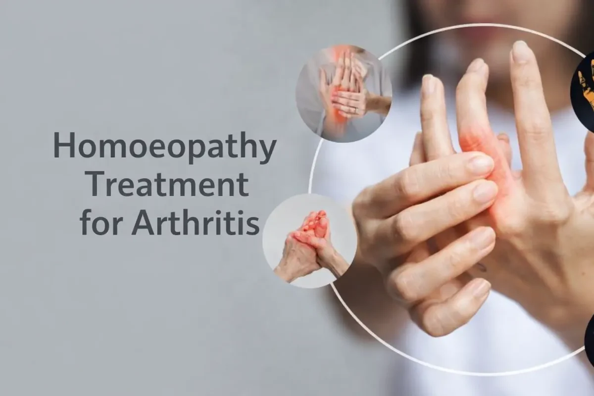 Homoeopathy Treatment for Arthritis: A Natural Approach to Pain Relief