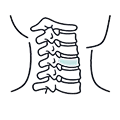목디스크