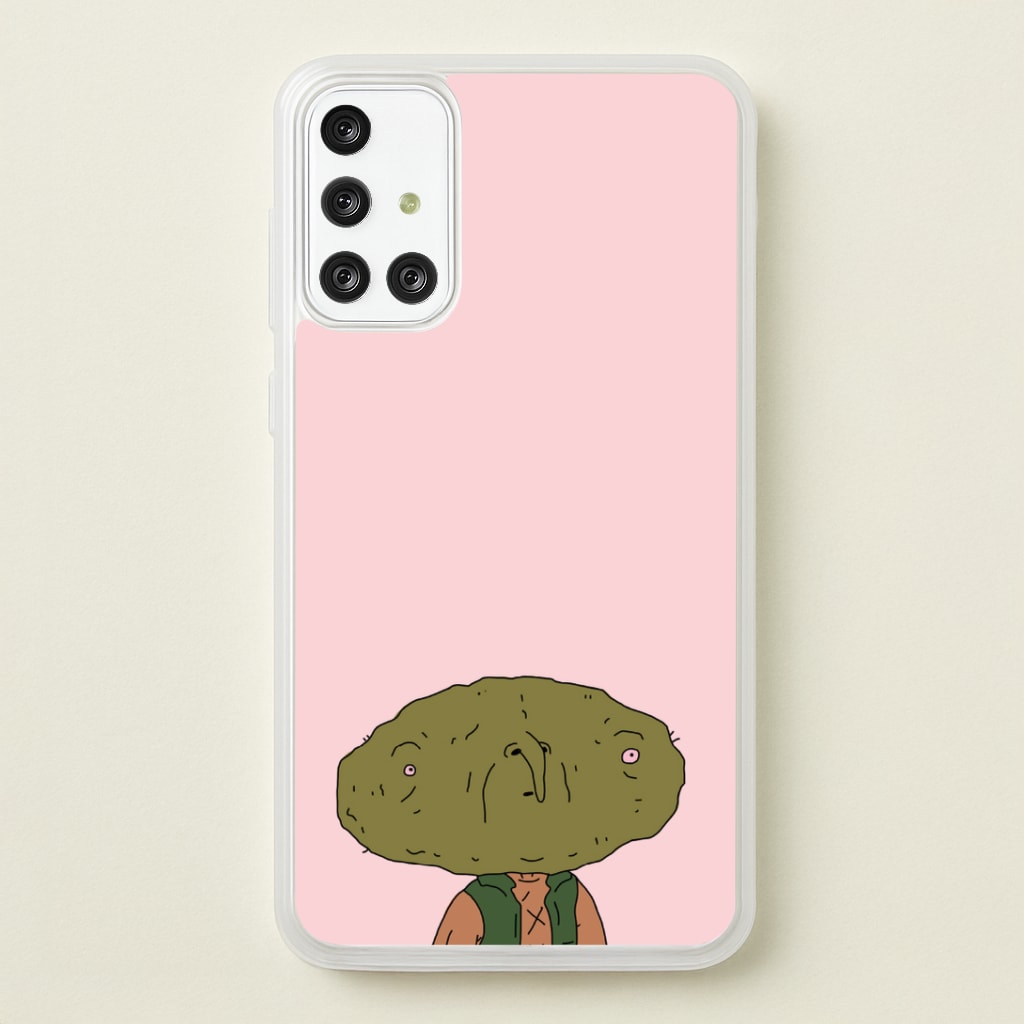 Nugget Man Phone Case