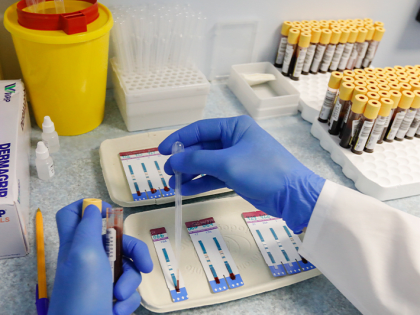 Врач рассказал, как чаще всего распространяется ВИЧ среди россиян