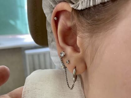 Видновские врачи извлекли из уха девушки провалившуюся сережку