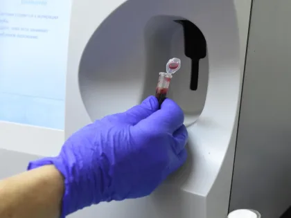 Опасный вирус из Конго: угроза для России?