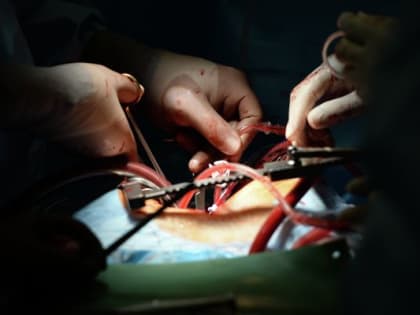 Эксперт назвала причину сердечно-сосудистых заболеваний