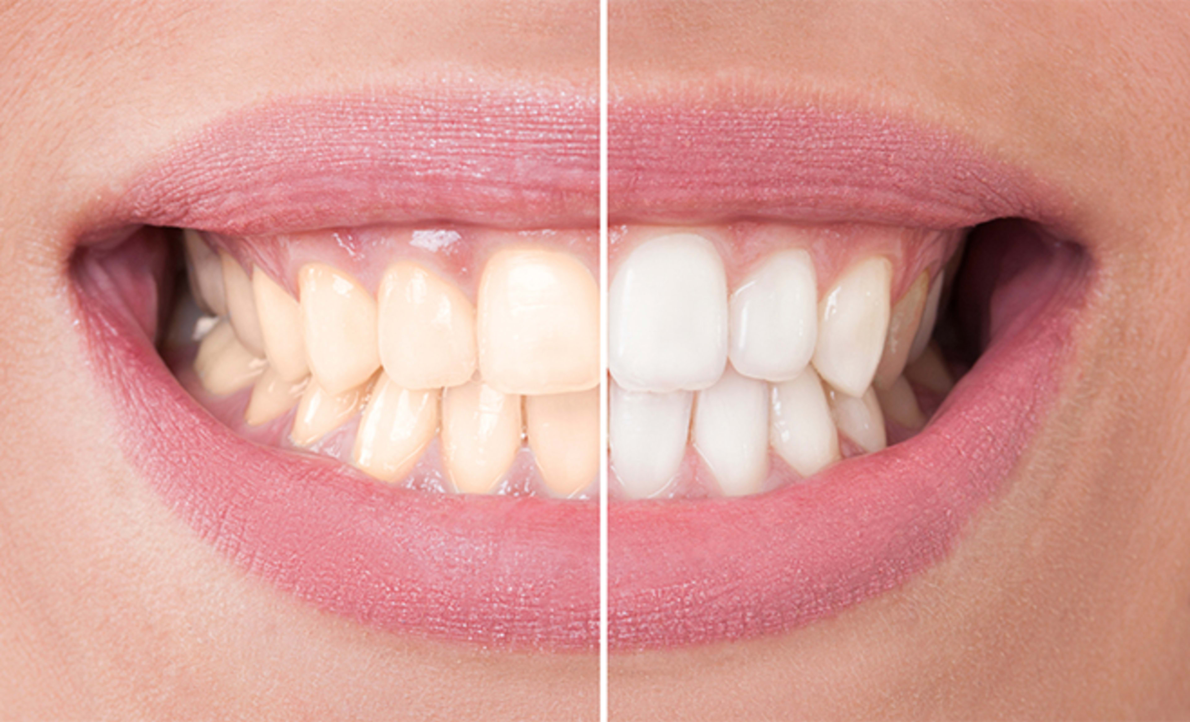 listing card gallery