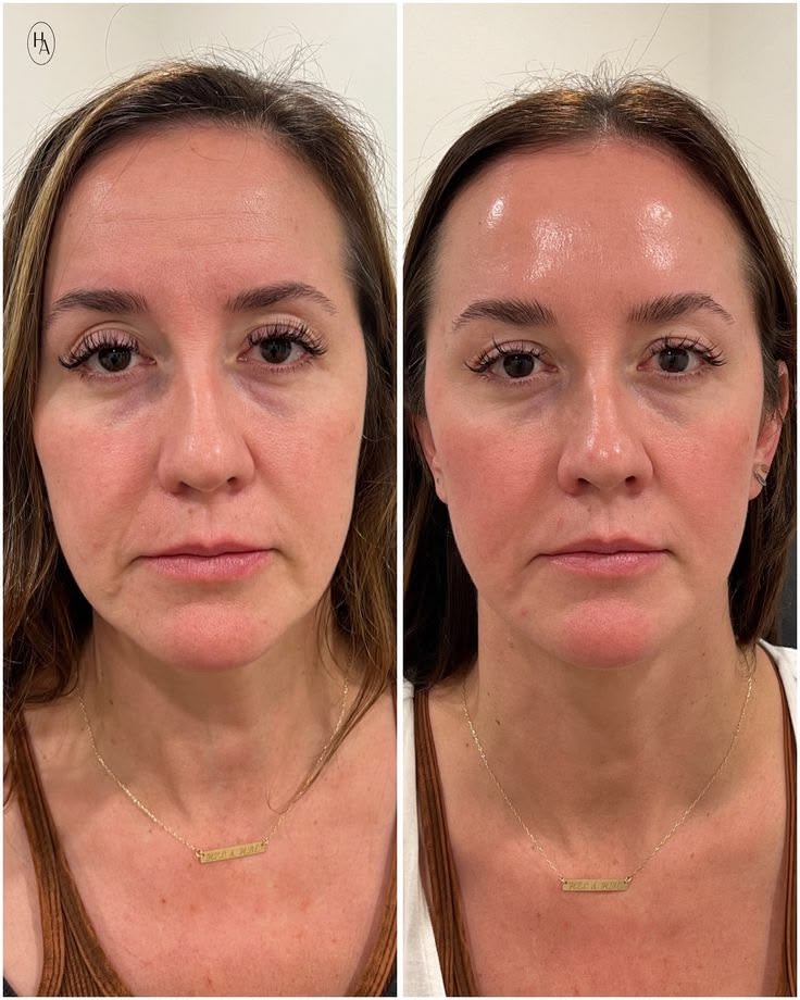 Antes y después visual de rostro con apariencia más luminosa