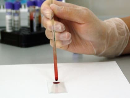 Бесплатное тестирование на ВИЧ в Барнауле