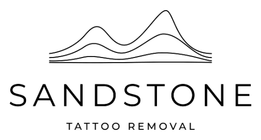 Sandstone Tattoo Removal