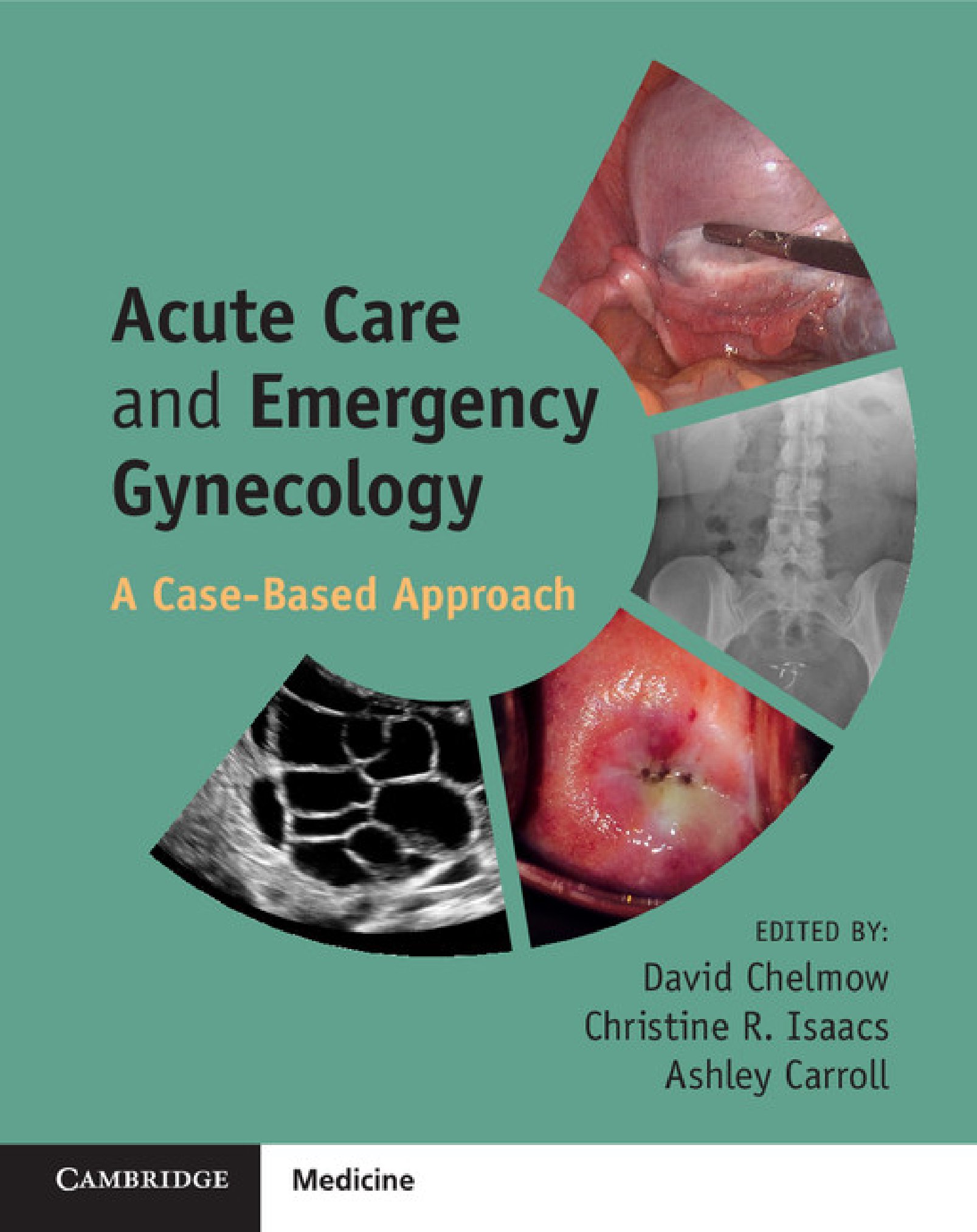 Acute care and emergency gynecology