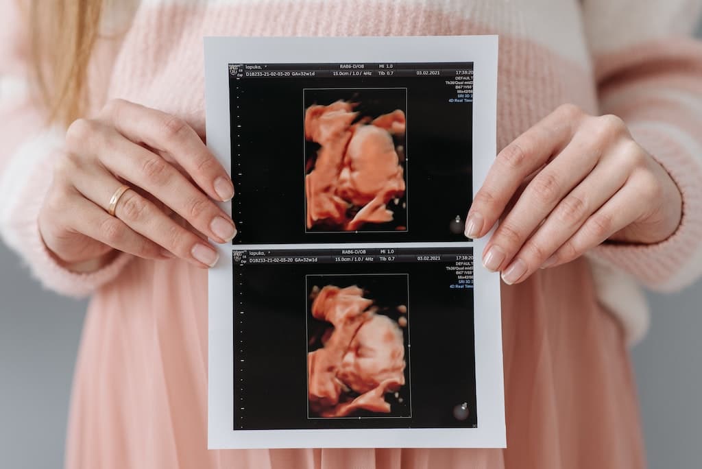 Aborto, eufemismo y evasión moral