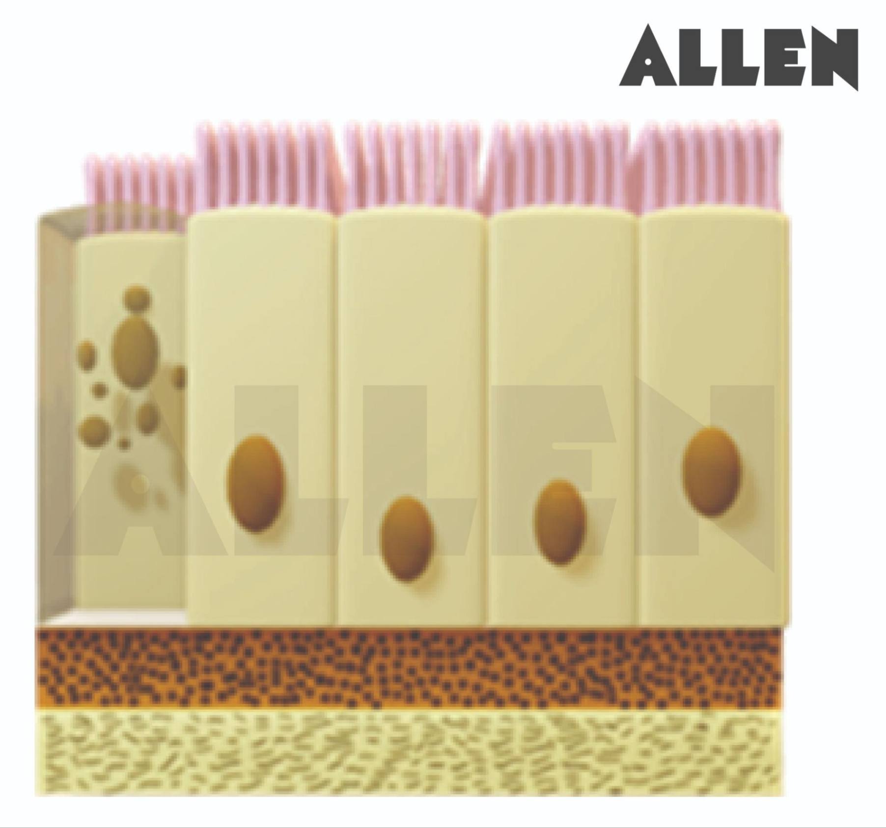 Glandular brush border columnar epithelium