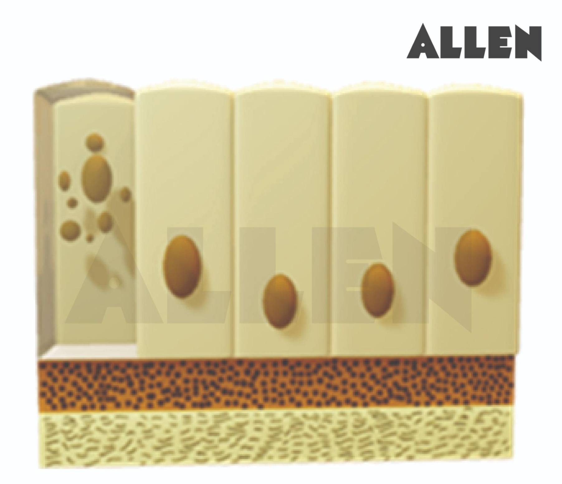 Glandular columnar epithelium