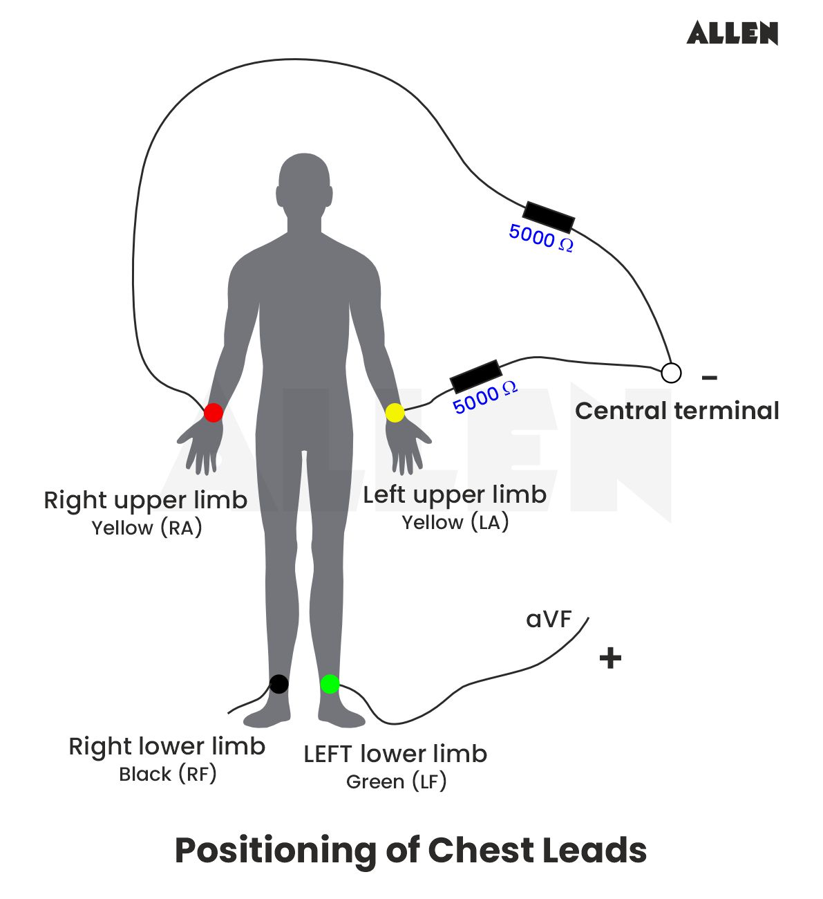 Image showing the positioning of chest leads for ECG