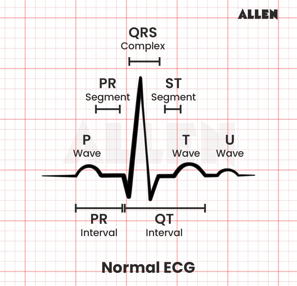 Electrocardiogram ECG Test Uses Process Of Electrocardiograph