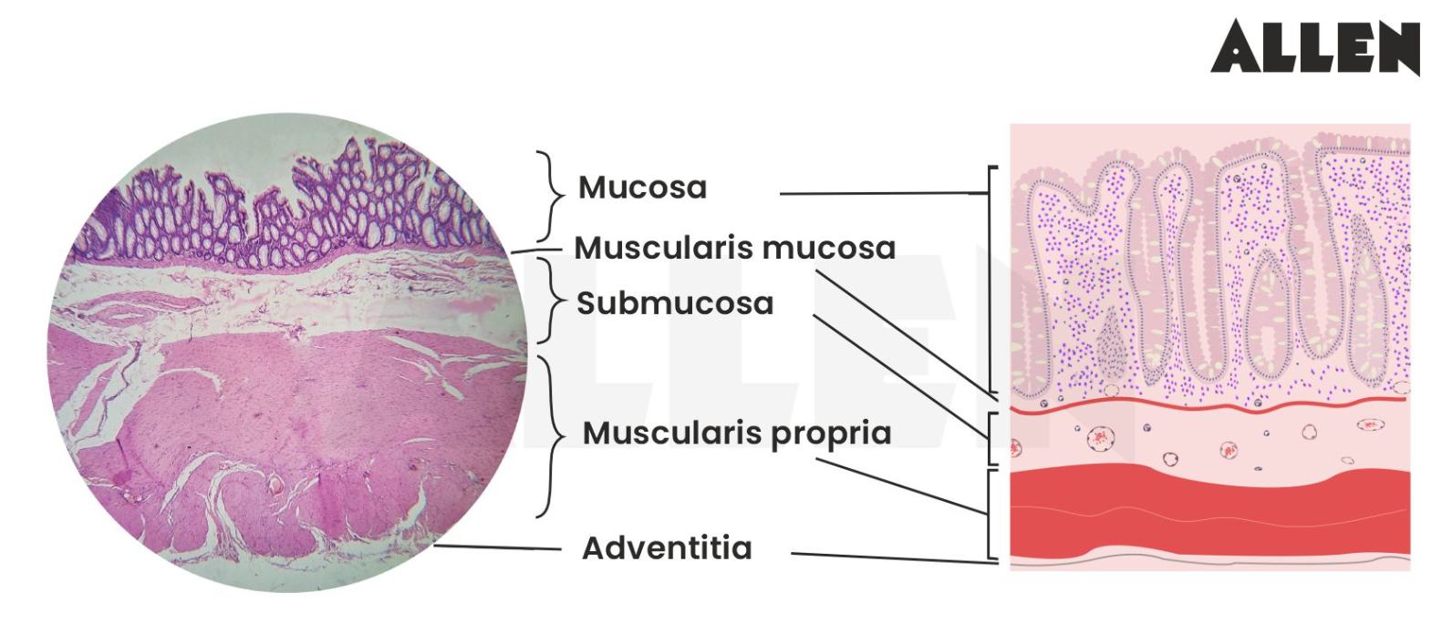 Image showing the histology of the large intestines