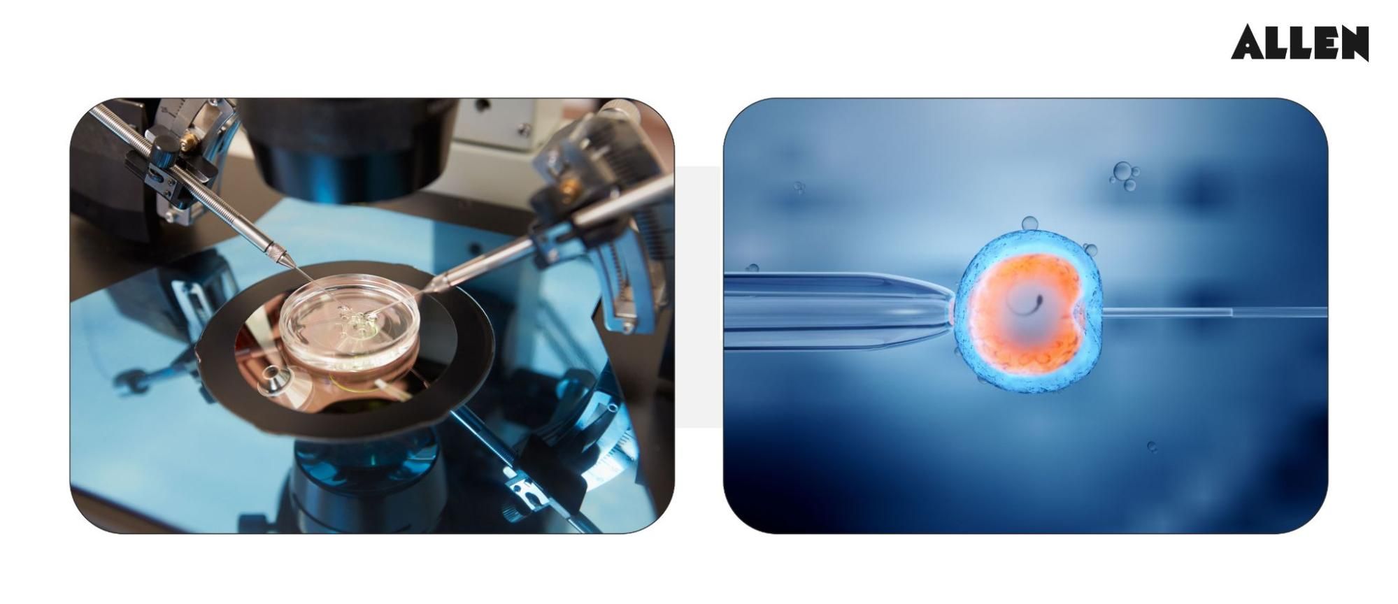 Image showing the fertilization stage during the Assisted Reproductive Technology