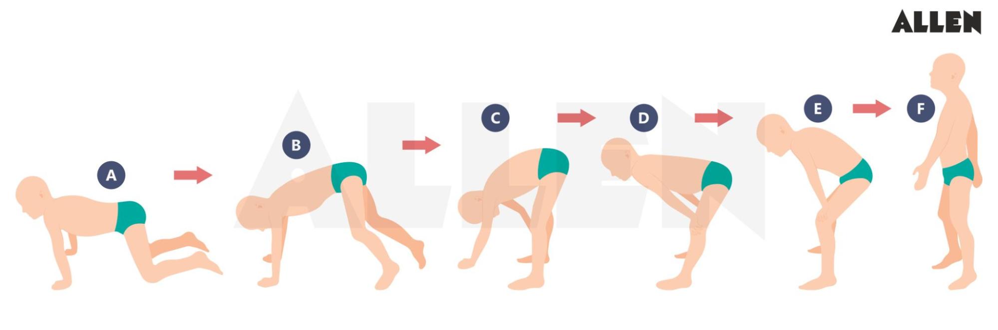 Duchenne Muscular Dystrophy