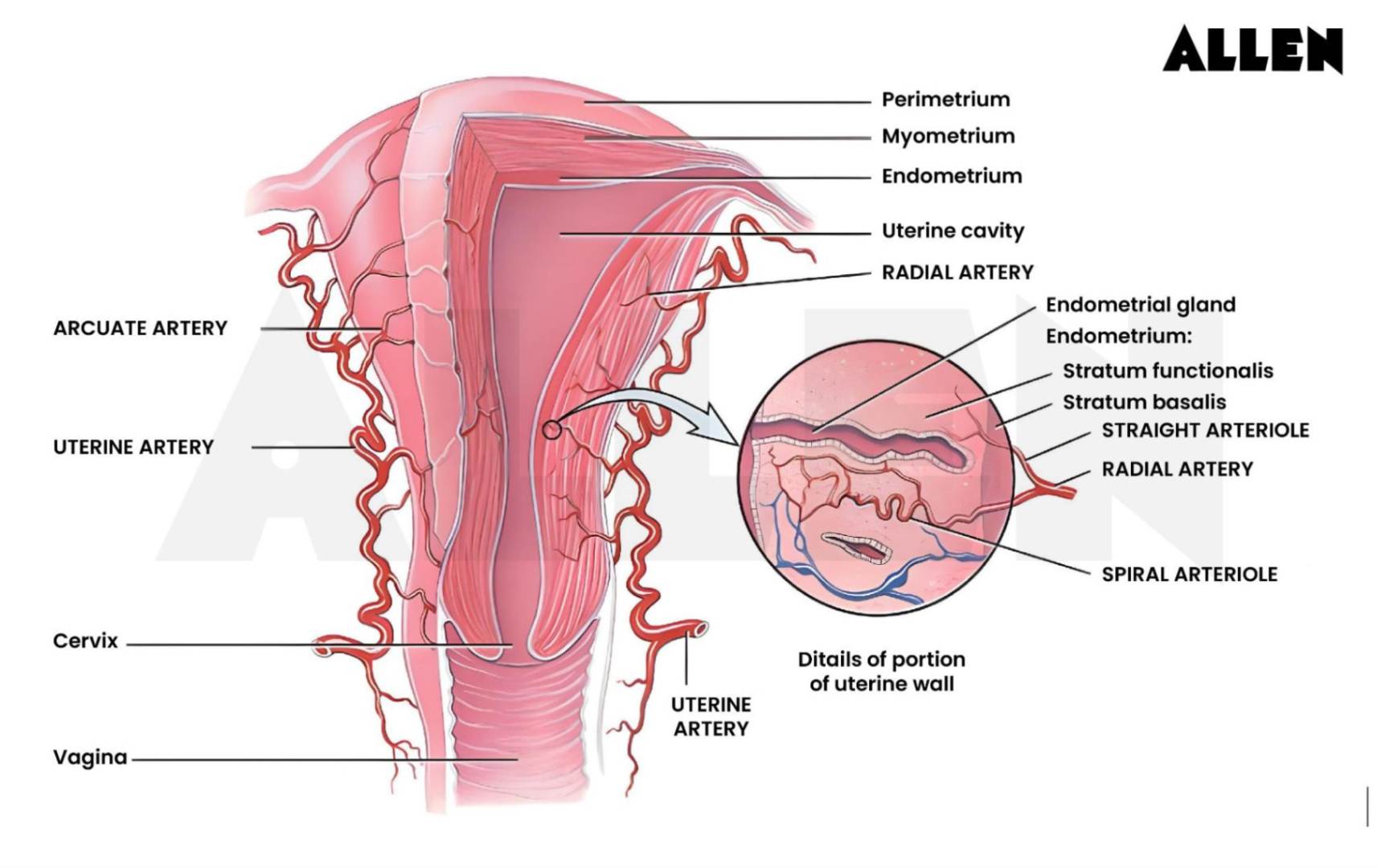 Division of the uterus