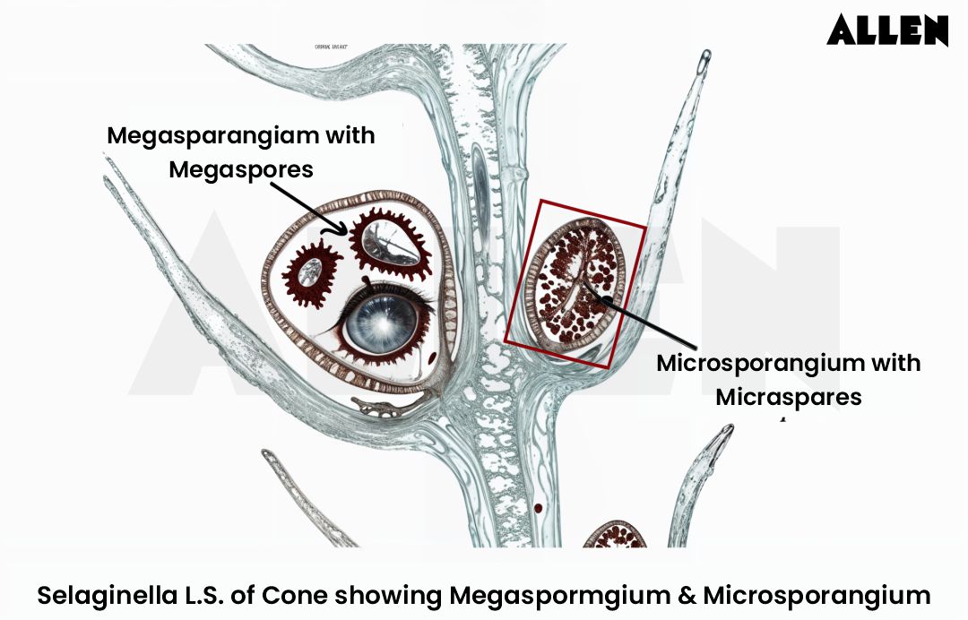 LS of Cone showing microsporangium and megasporangium