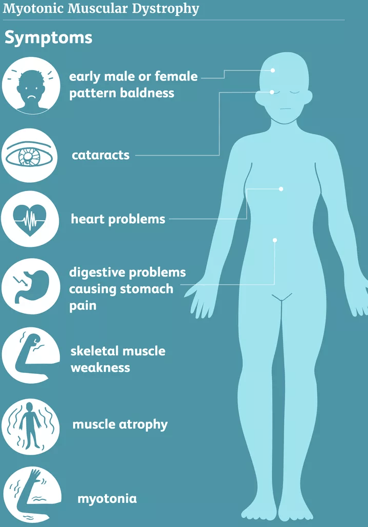 Myotonic Dystrophy