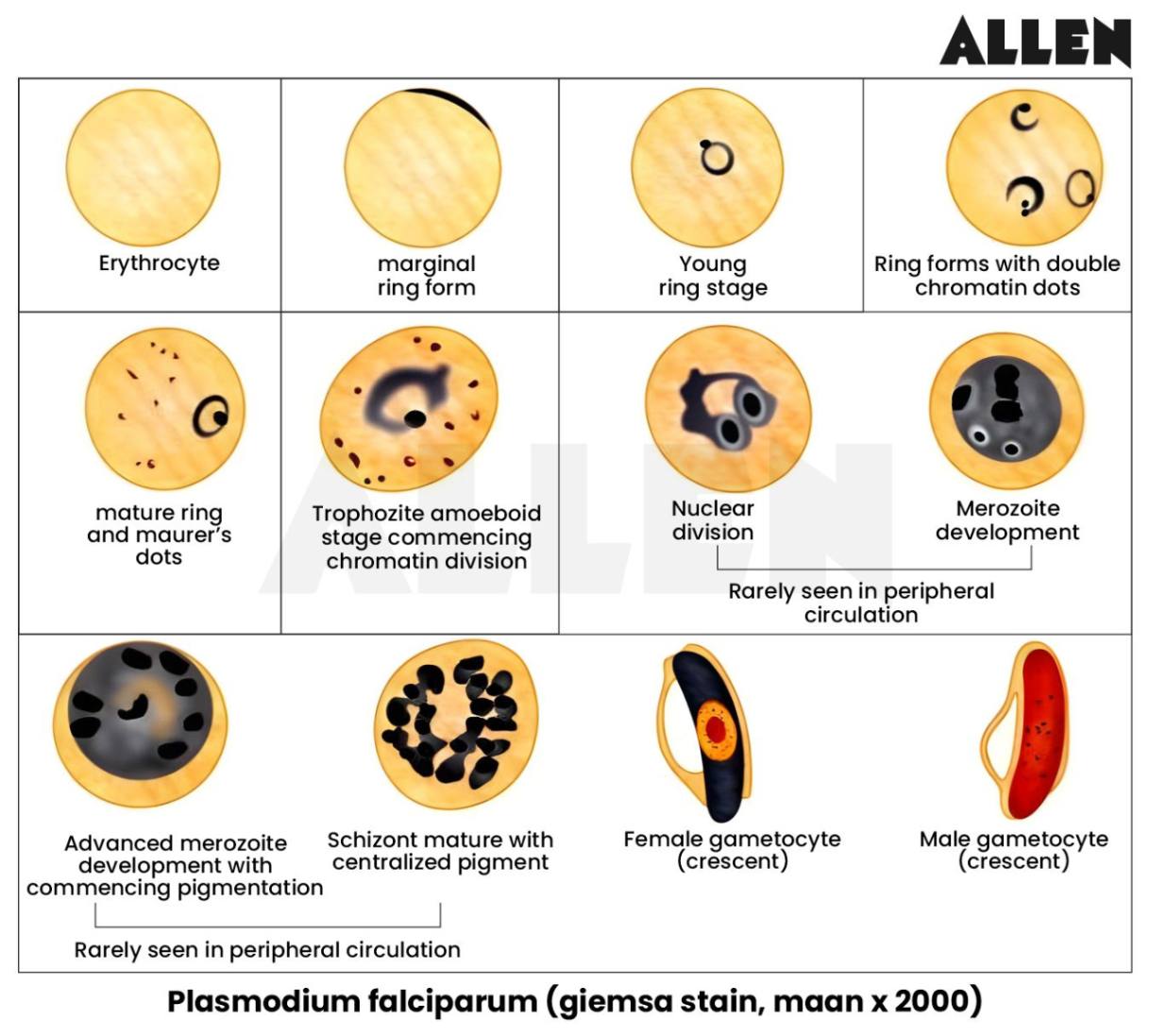 Plasmodium Falciparum