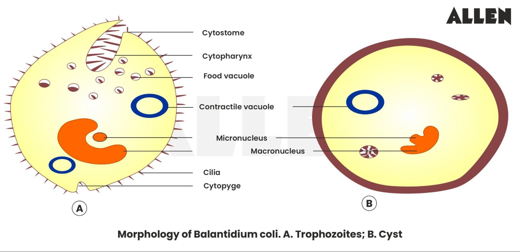 Balantidium coli