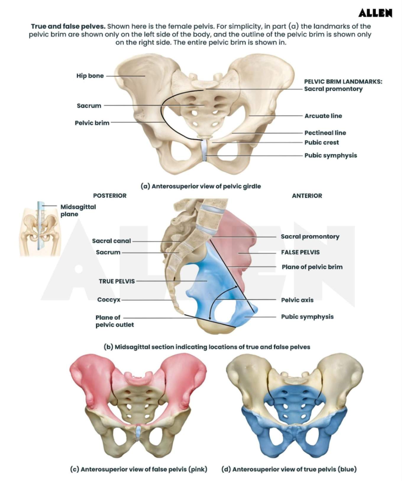 False and True Pelvis