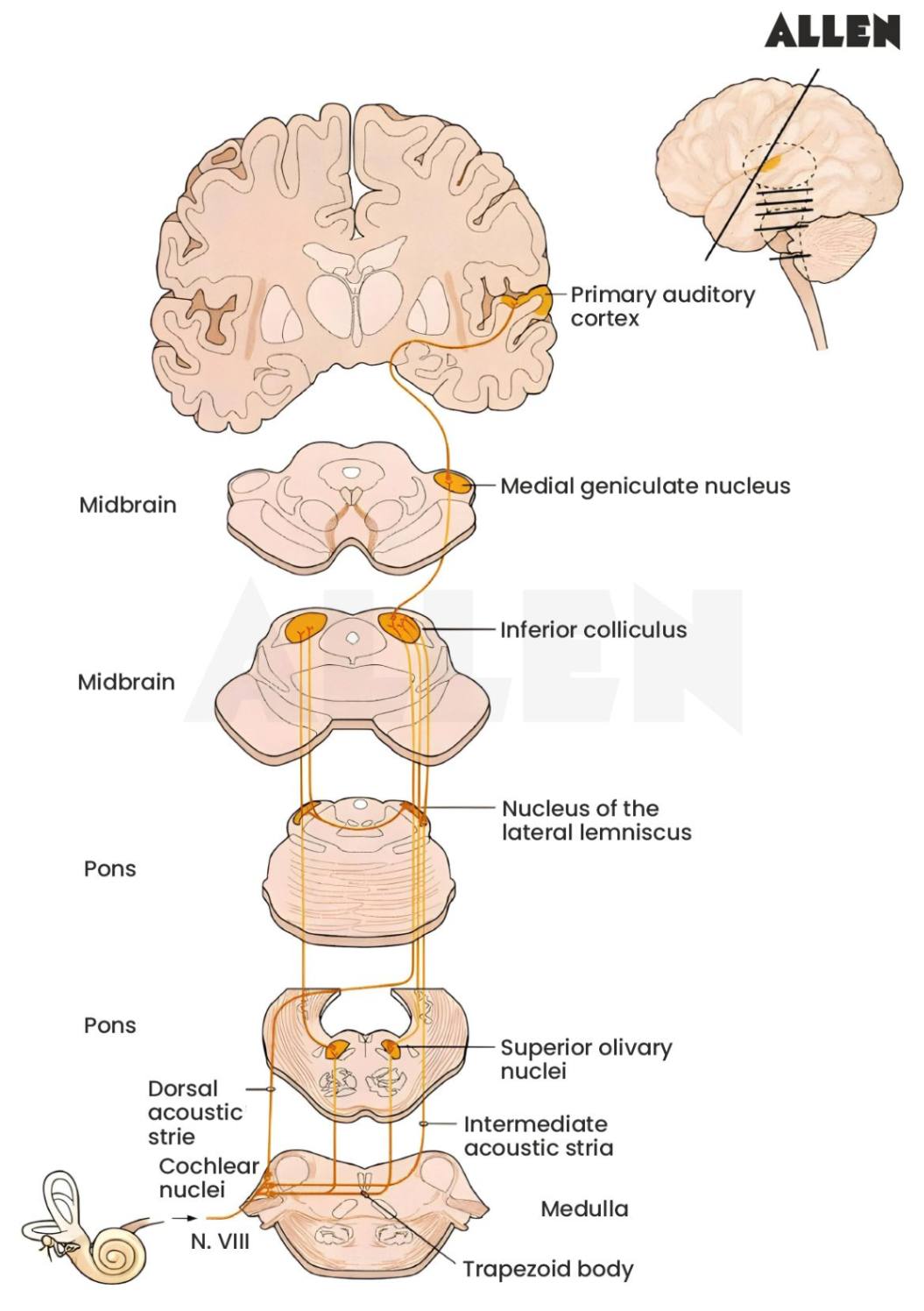 Central component of auditory pathway