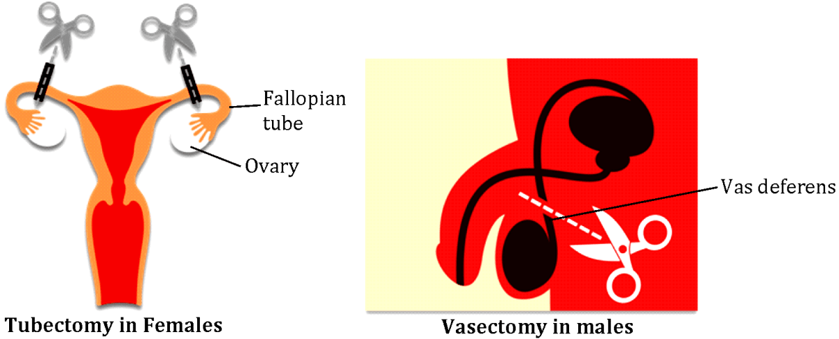 Reproductive Health| Understanding STDs and Contraceptive Methods
