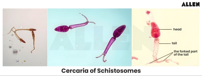 Cercaria Schistosomes