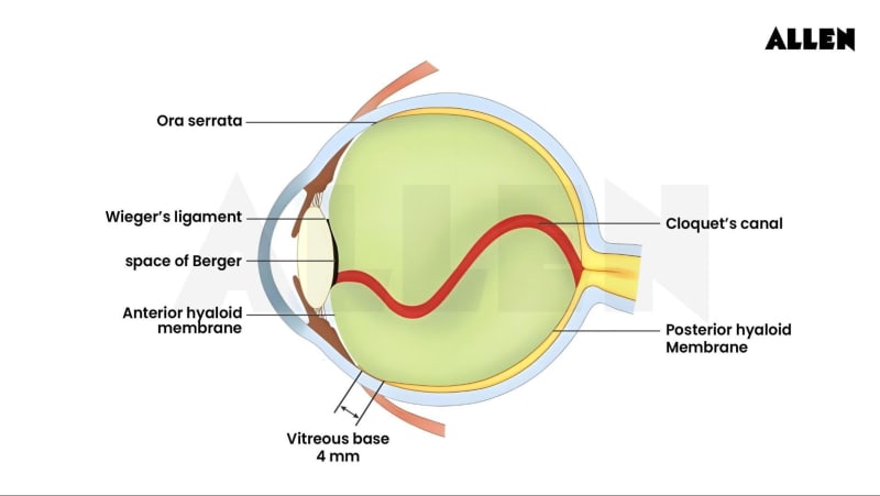Attachment of Vitreous