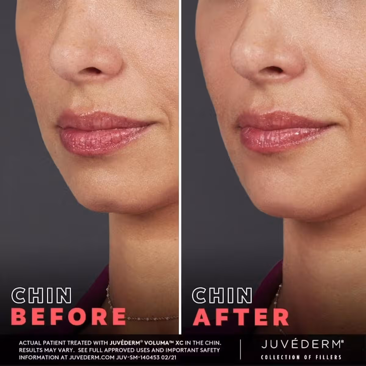 Before and after patient results