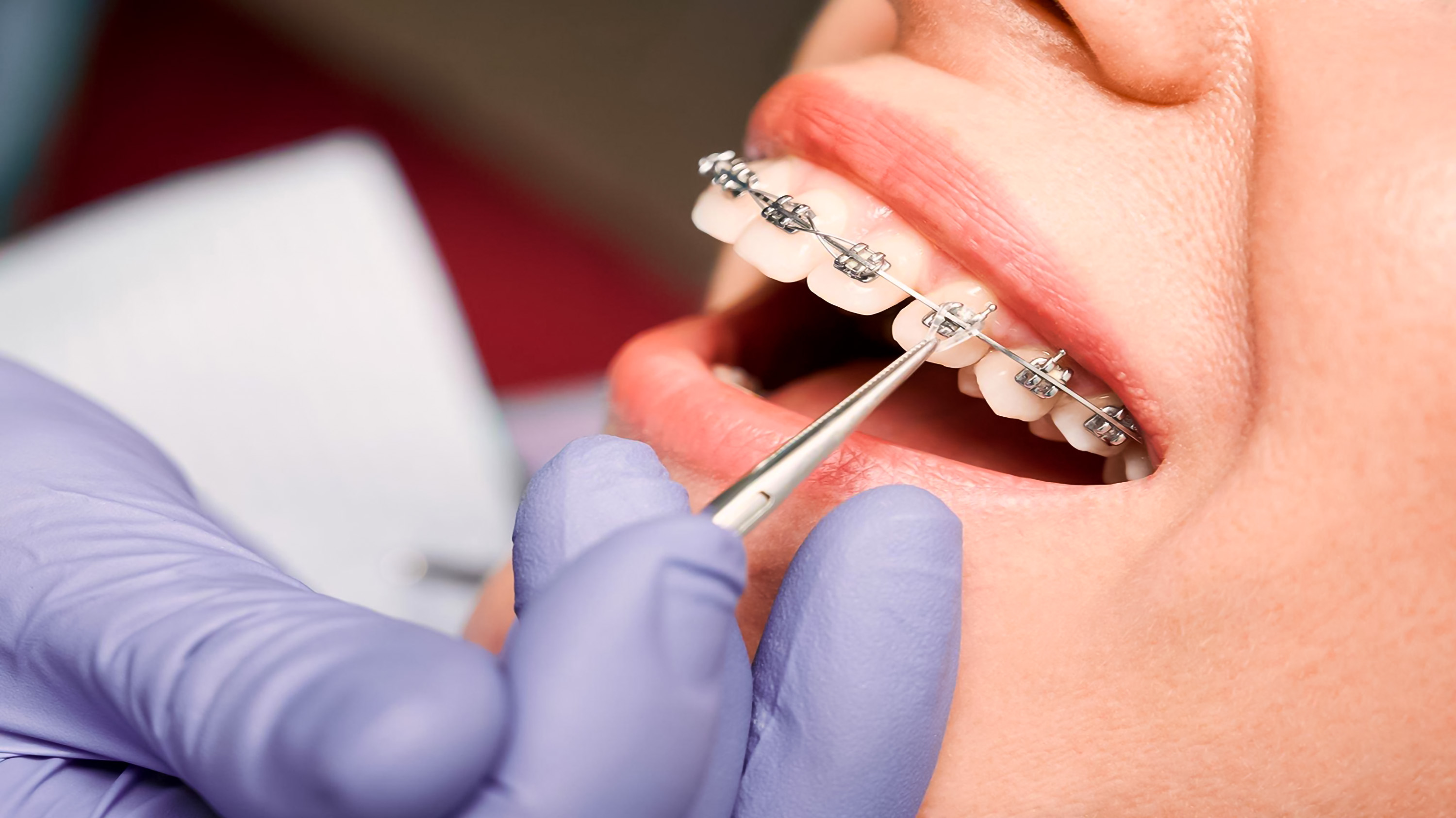 Michael J Kania, DDS, PA Specialist in Orthodontics - Expert