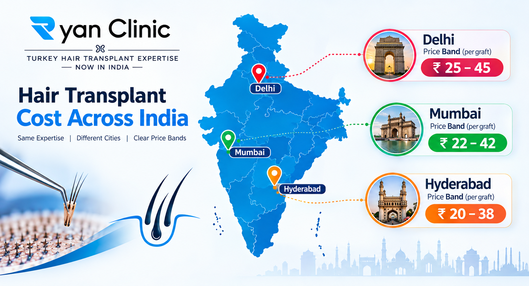 Hair transplant cost compared in Delhi Mumbai and Hyderabad