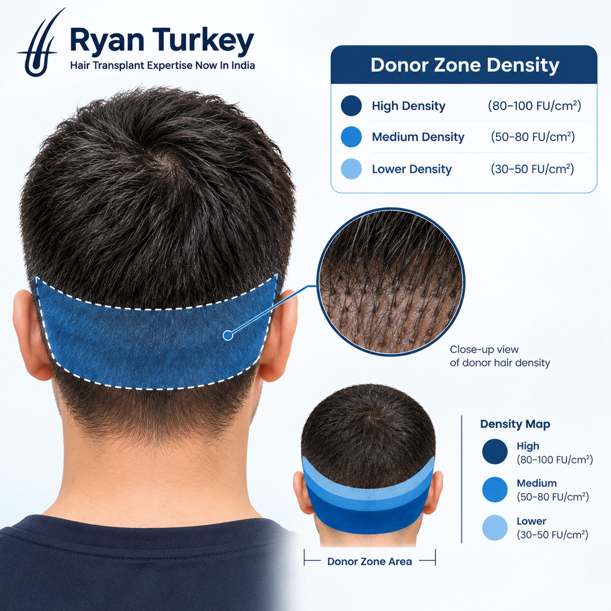Measuring donor density