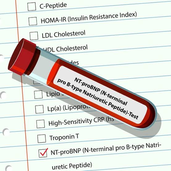 Blood tests required before a hair transplant in India