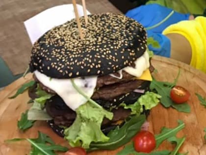 Здоровье сосудов: почему важно следить за состоянием ваших кровеносных сосудов