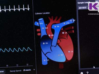 Врач назвал опасный симптом за три года до инфаркта: первой заметила жена