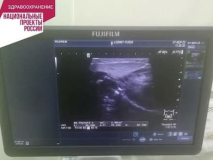 Материально-техническая база Усинской центральной районной больницы пополнилась новым аппаратом УЗИ ARIETTA 65