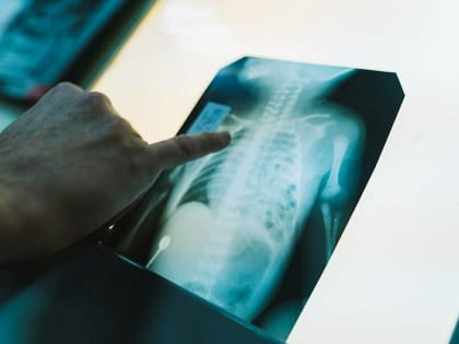 Дума предложила ввести обязательное страхование ответственности медработников