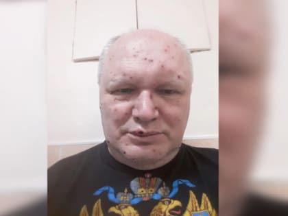 Известный в Коми политолог рассказал о своем состоянии после взрыва в Санкт-Петербурге