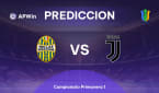 Hellas Verona Sub-20 vs Juventus Sub-20 | Pronóstico | Campionato Primavera 1 | 14/12