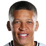 Dwight Gayle foto de rosto