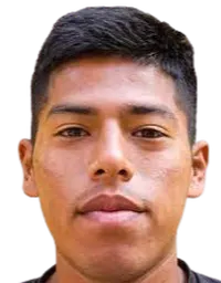 Renzo Salazardisparo a la cabeza