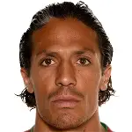 Bruno Alvesdisparo a la cabeza