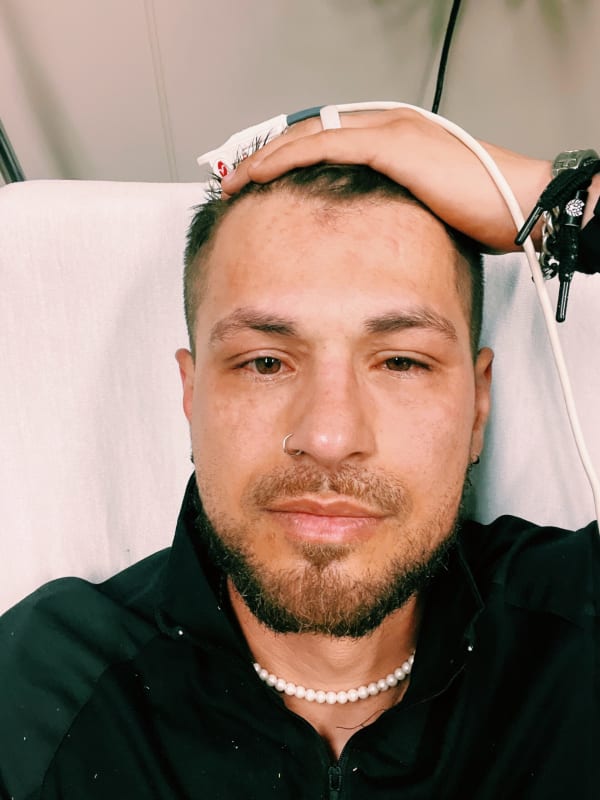 S3 James goes to hospital after alergic reaction